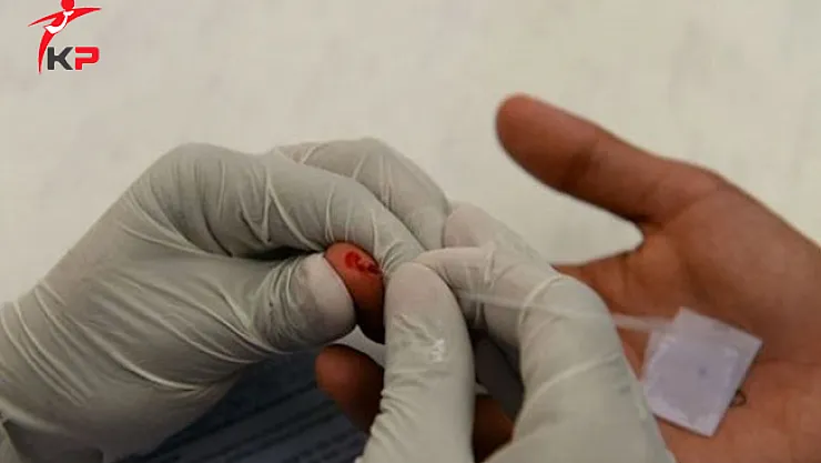 HIV Nedeniyle Ölümler Son 10 Yılda Yüzde 50 Azaldı