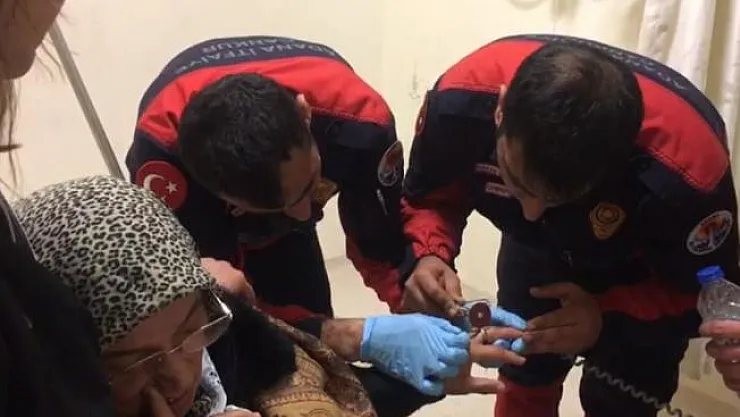 İtfaiyeden yüzük çıkartma operasyonu