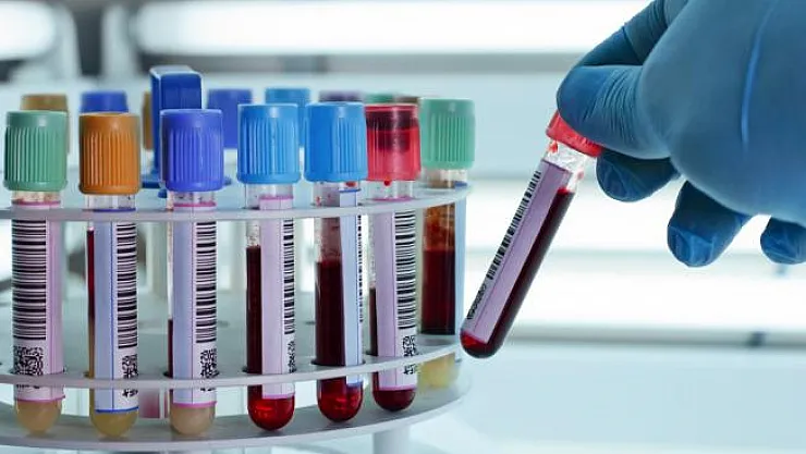 Kanser bu test ile erken teşhis edilebilecek!