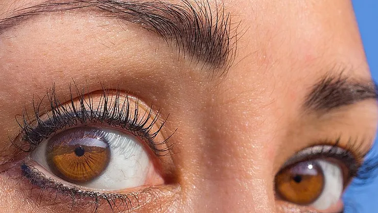 Kaşlarınız bu şekildeyse hasta olabilirsiniz! Hemen bakın