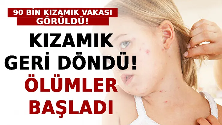 Kızamık Geri Döndü: Ölümler Başladı
