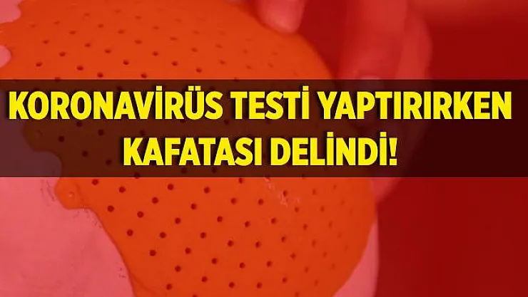 Korkunç olay! Koronavirüs testi yaptırırken kafatası delindi!