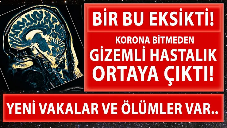 Koronavirüs bitmeden bir gizemli hastalık daha ortaya çıktı!