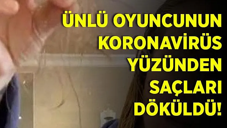 Koronavirüse yakalanan ünlü oyuncunun saçları döküldü!