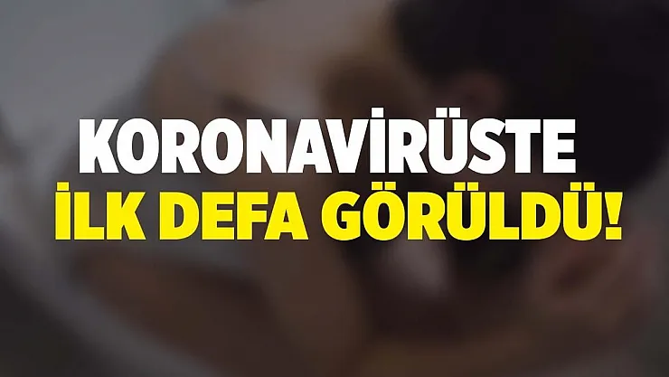 Koronavirüsün ilk defa tespit edilen yan etkisi ortaya çıktı!