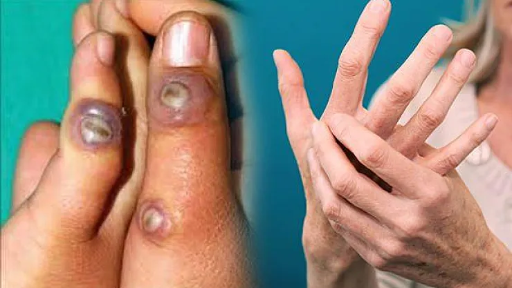 Kurban Bayramı'na sayılı gün kala bu hastalığa dikkat edin!