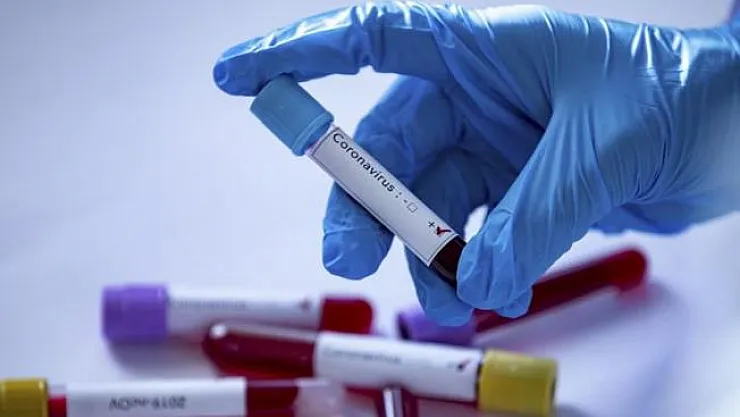 Meclis doktorunda Corona virüsü çıktı!