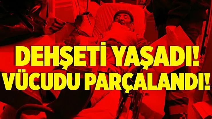 Misafir olarak gitmişti! O evde dehşeti yaşadı! Yüzünden, kollarından ve bacaklarından et koparıldı!