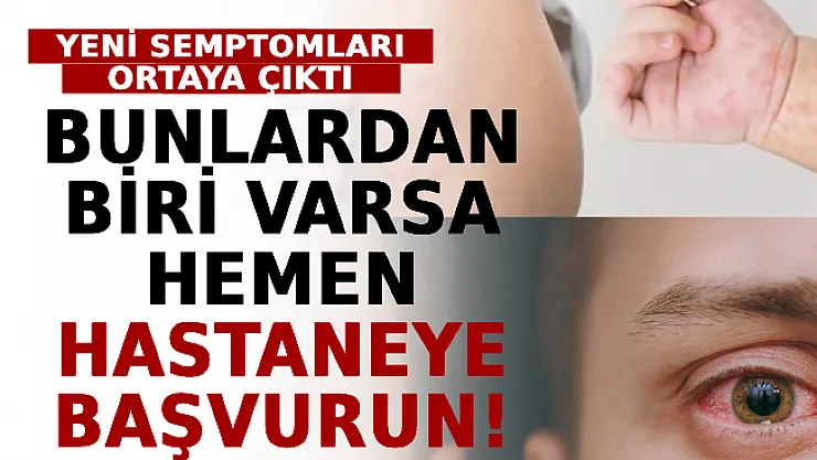 Omicron'un Yeni Semptomları Ortaya Çıktı! Bunlardan Biri Varsa Hemen Hastaneye Başvurun!