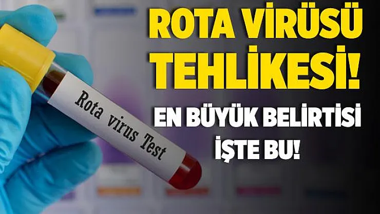 Rota virüsü tehlikesi! Bu belirtilerle kendini gösteriyor!
