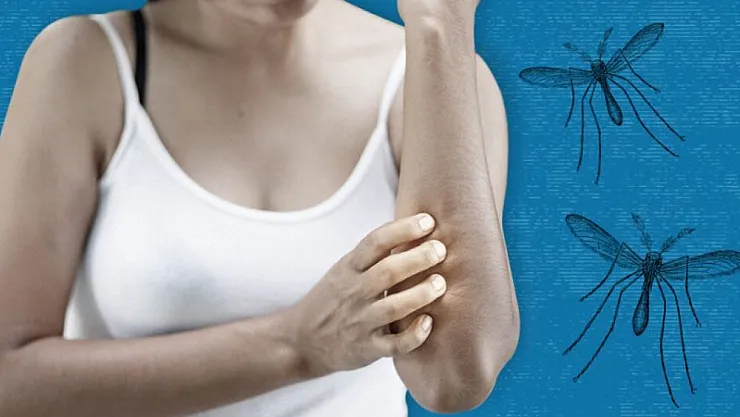 Sivrisinek kabusuna doğal kalkan: Sadece birkaç damlası yetiyor, işte o mucize yöntemler!