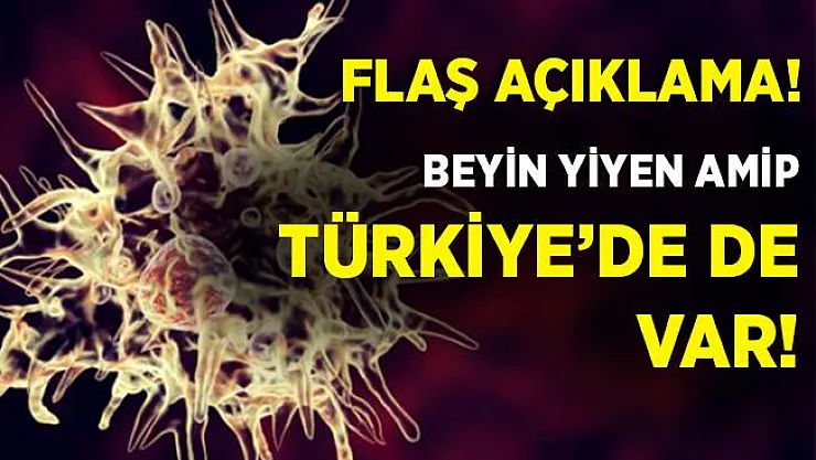 Şoke eden açıklama! Beyin yiyen amip, Türkiye'de de var!