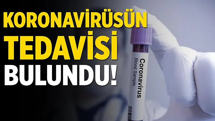 Sonunda müjdeli haber geldi! Koronavirüsün tedavisi bulundu!