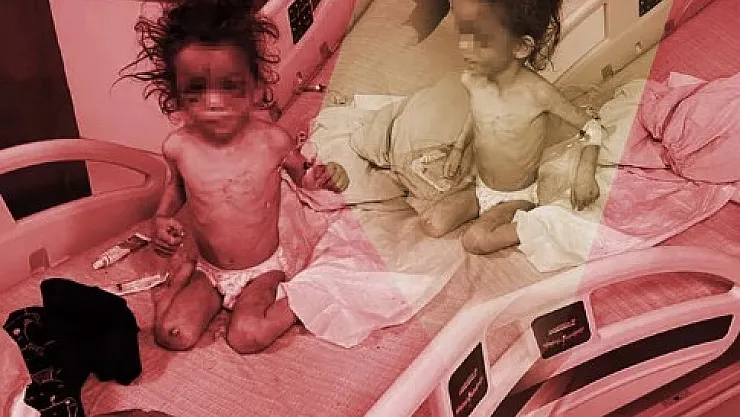 Tüm Türkiye bu anne vahşetini konuşuyor: 5 yaşındaki çocuğunu günlerce işkence ederek aç bıraktı! Durumu kritik