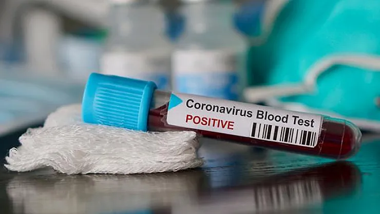 Türkiye'den ABD'ye Giden Bir Kişide Corona Virüsü Tespit Edildi ! İşte Yapılan Açıklama