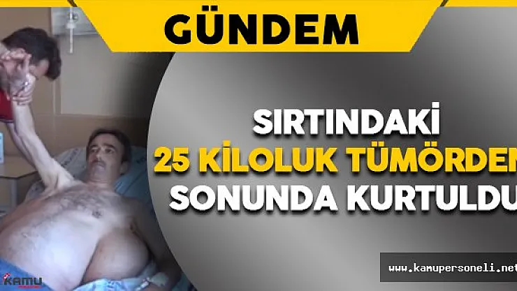 Yıllar Sonra Sırtındaki 25 Kiloluk Tümörden Kurtuldu