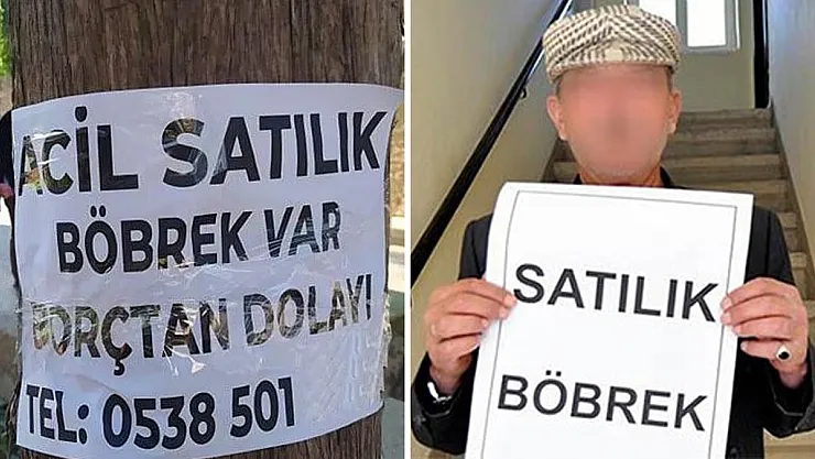 Yoksulluktan Böbrek Satışı Patladı! En Çok Bu 3 İl Satmak İstiyor